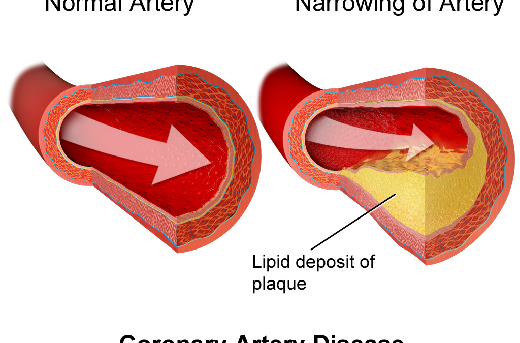 A healthy heart diet